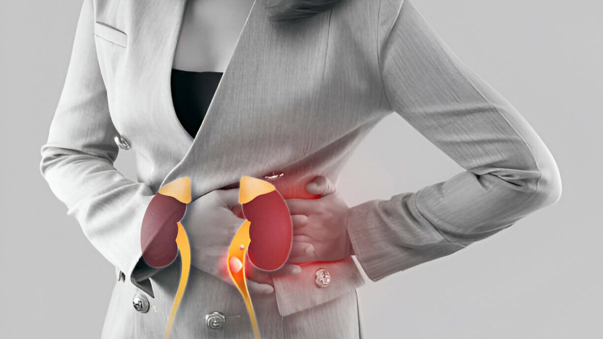 Kidney Stone Doctor in Chandigarh