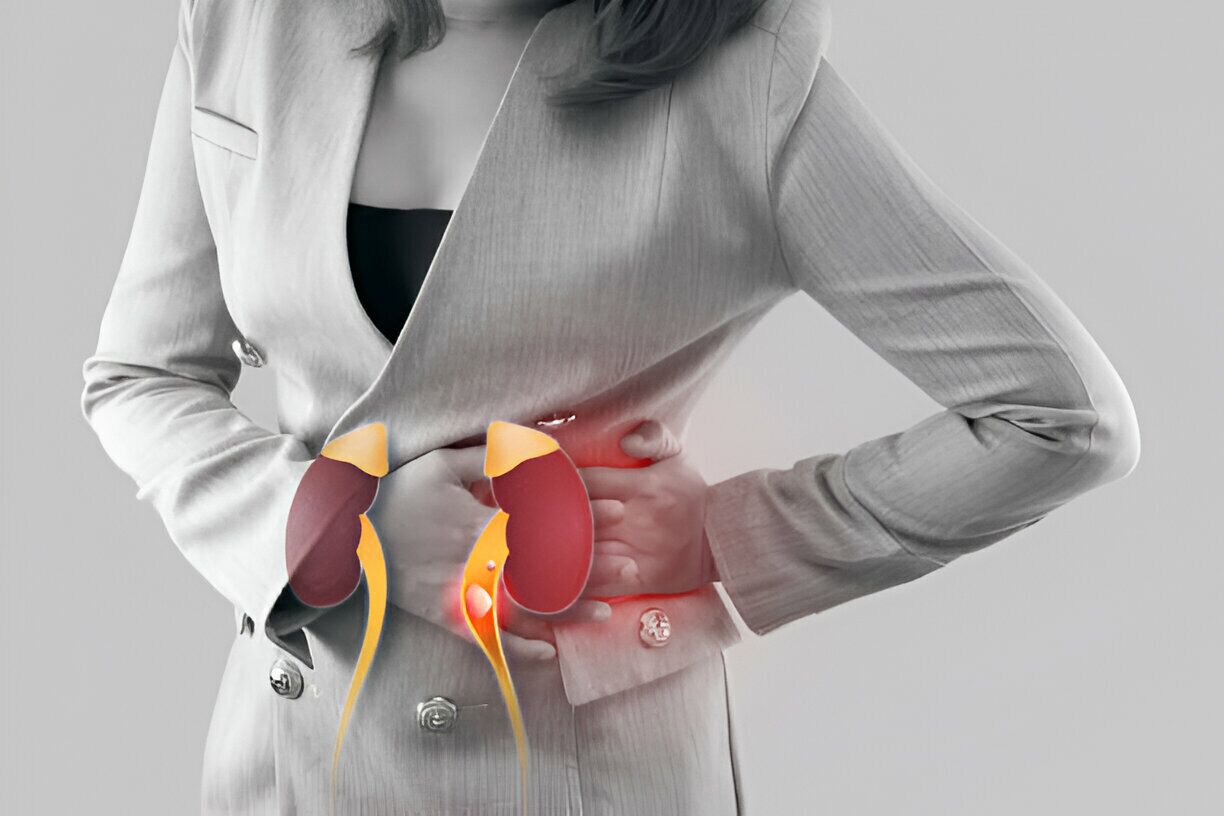 Kidney Stone Doctor in Chandigarh