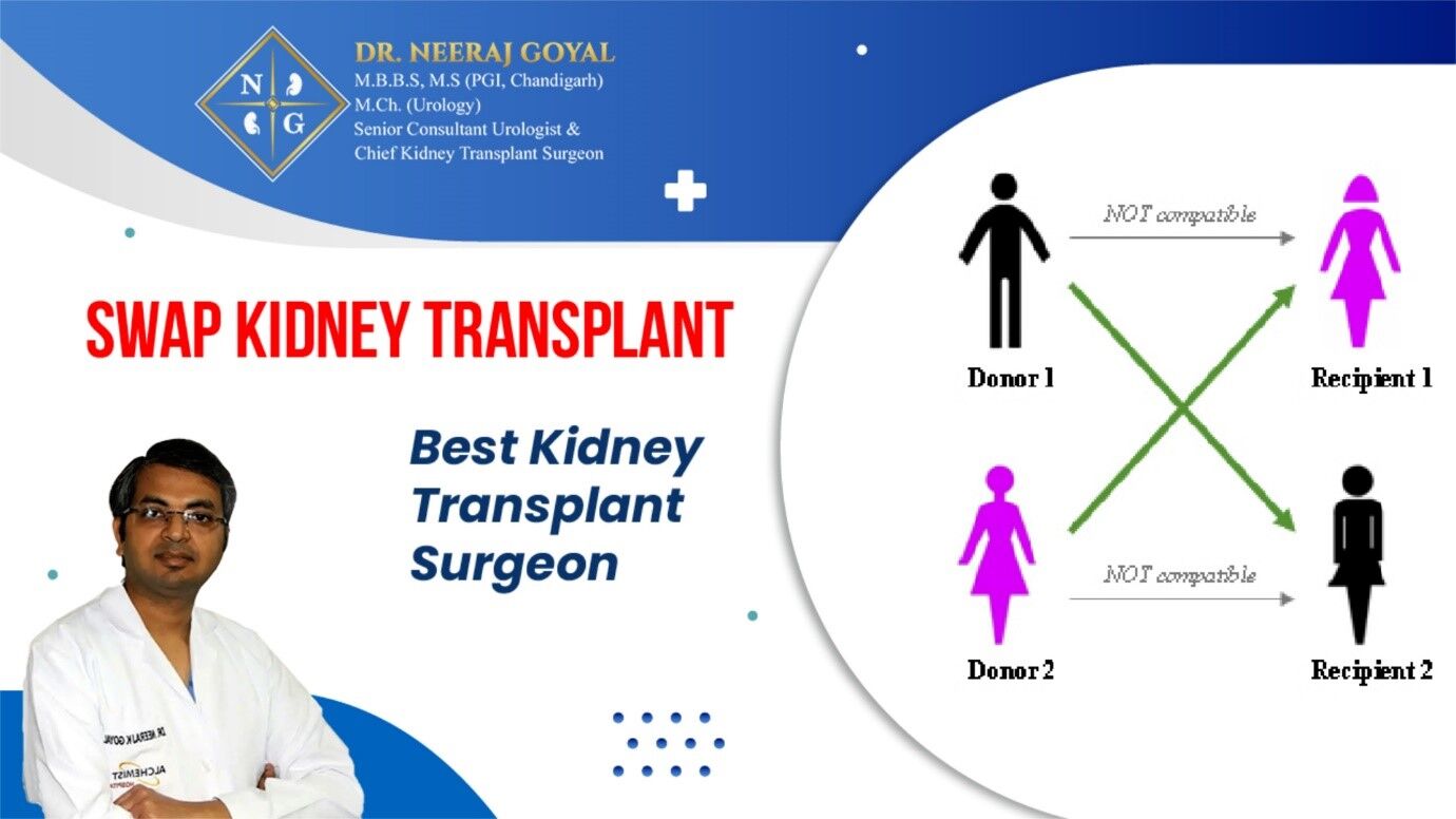 Swap Kidney Transplants